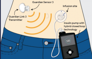 The signal conditioning techniques used with closed-loop current sensors